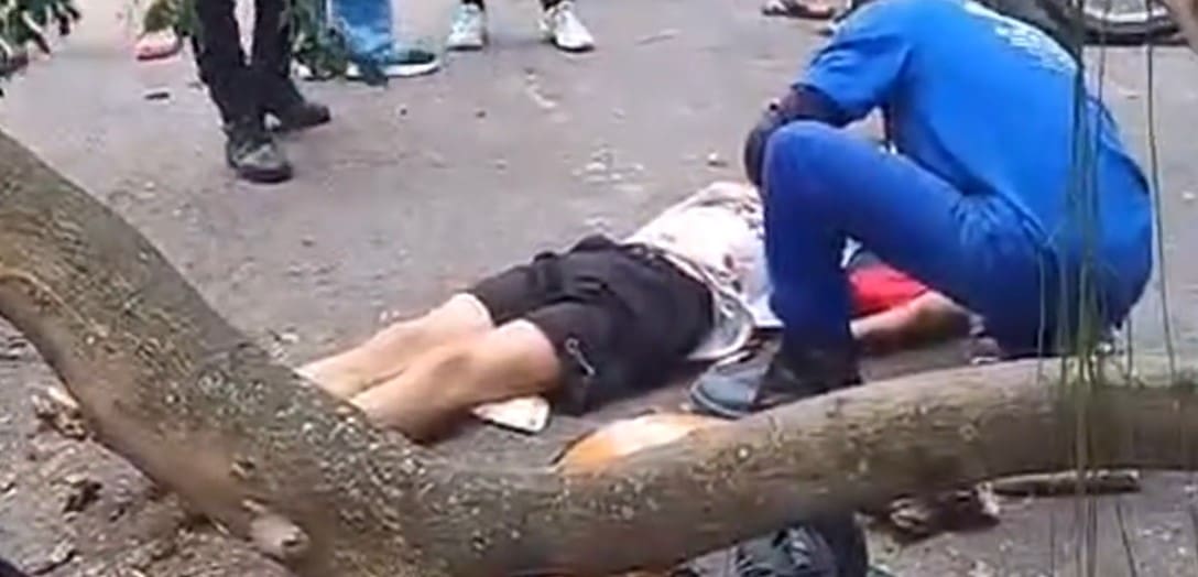 Árvore atinge jovem em cheio ao cair em Laranjeiras Zona Sul do Rio de Janeiro