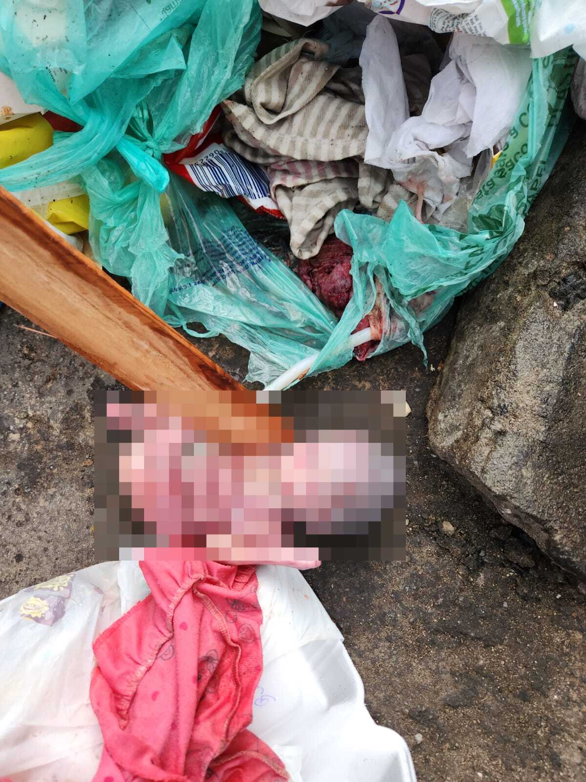 Feto humano é abandonado na Vila Kenedy, no Rio de Janeiro
