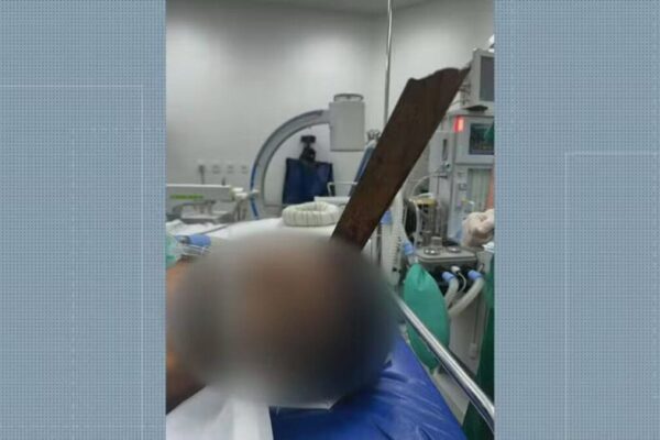 Homem sobrevive após estaca de m (1)