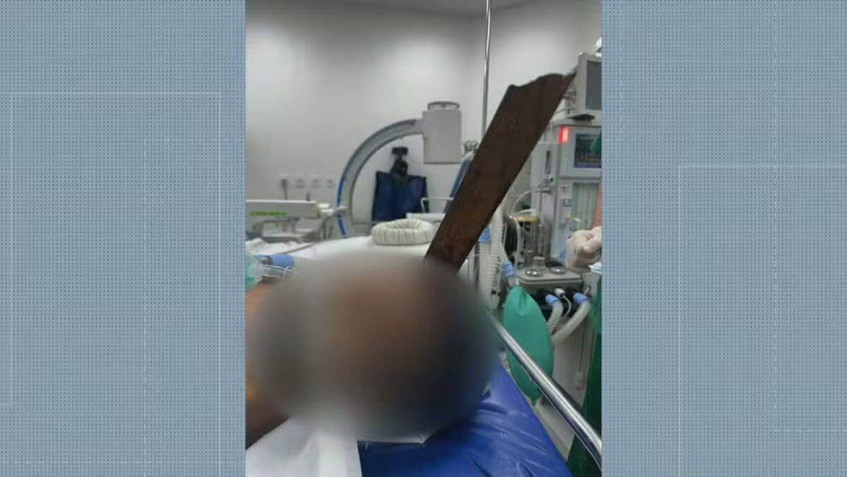 Homem sobrevive após estaca de m (1)