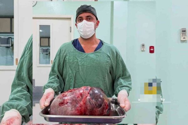 Médico retira tumor de mais de 15k de paciente em Rio das Ostras, no Estado do Rio de Janeiro