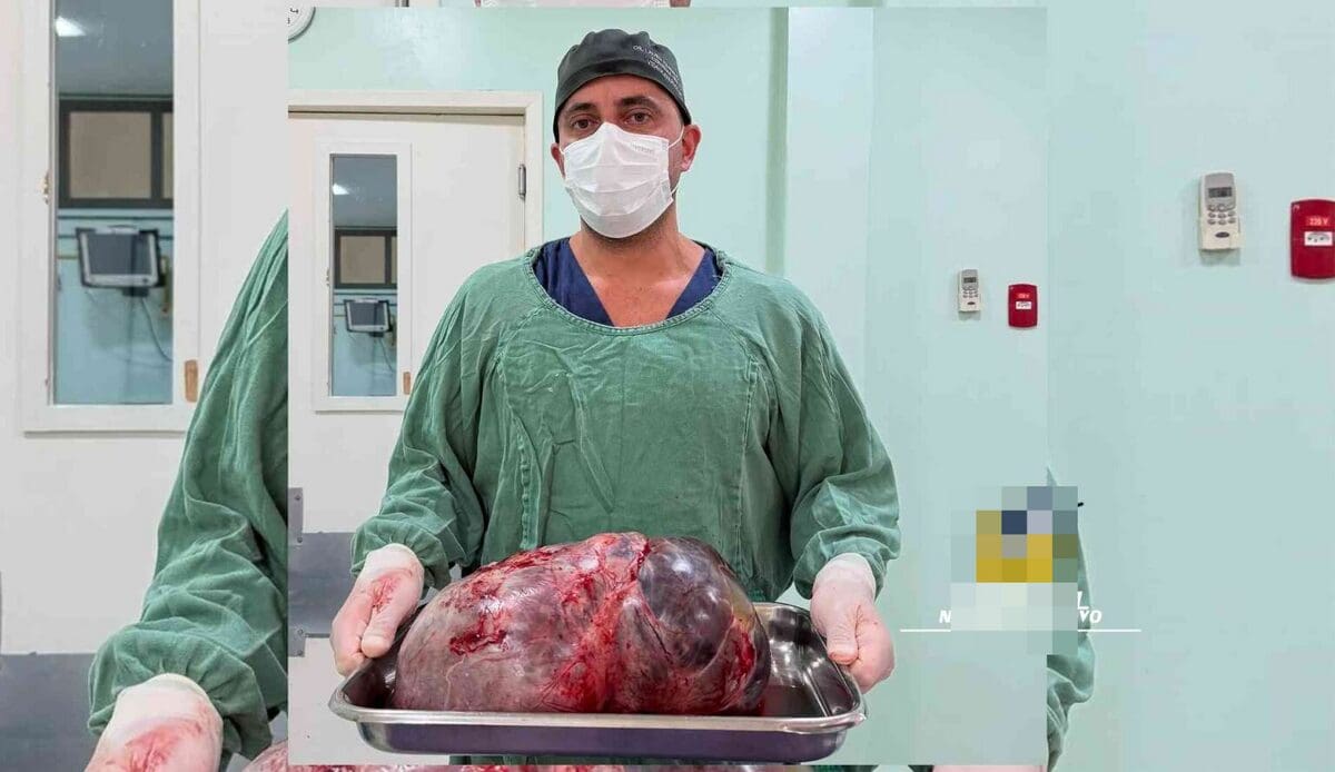 Médico retira tumor de mais de 15k de paciente em Rio das Ostras, no Estado do Rio de Janeiro