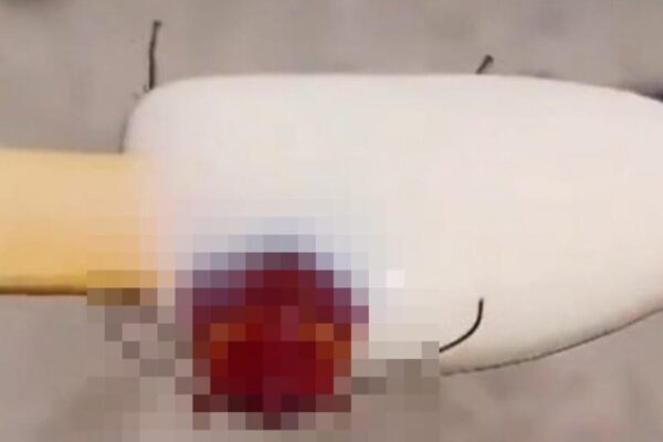 Mulher compra picolé e encontra barata congelada dentro do produto, na Praia do Recreio, no Rio de Janeiro