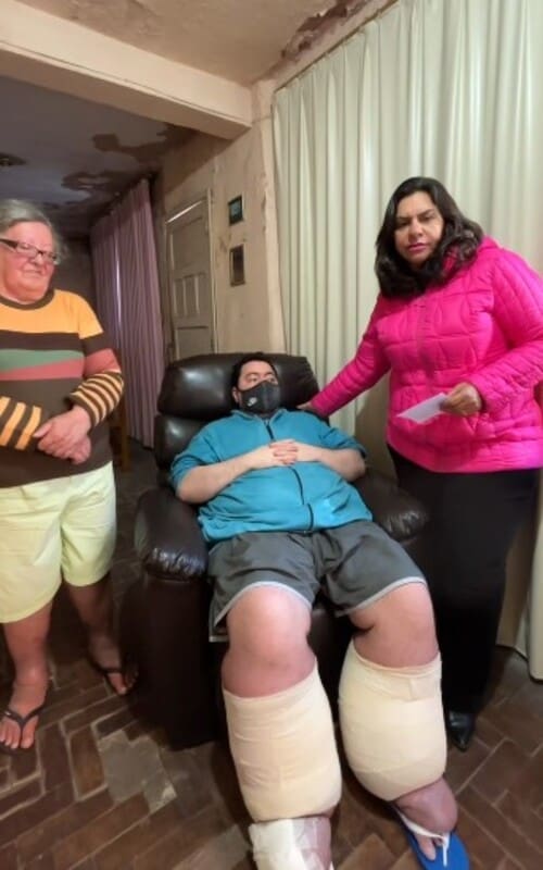 Ramom é morador de Nova Friburgo e tem chance de tratar o linfedema em Ribeirão Preto-SP