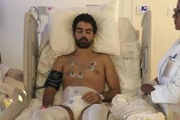Paciente em leito hospitalar com eletrodos e monitoramento, possivelmente recebendo tratamento.