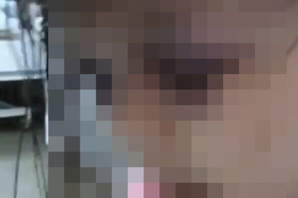 Rosto de criança com sinais de agressão.