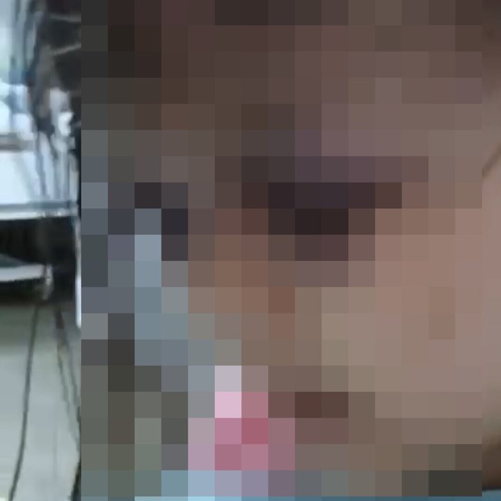 Rosto de criança com sinais de agressão.