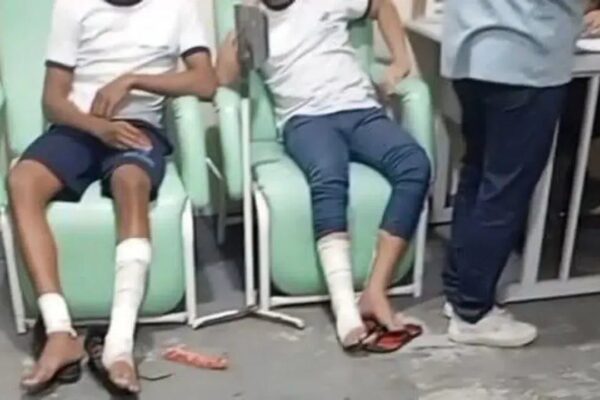 Estudantes com pernas enfaixadas após explosão em escola.