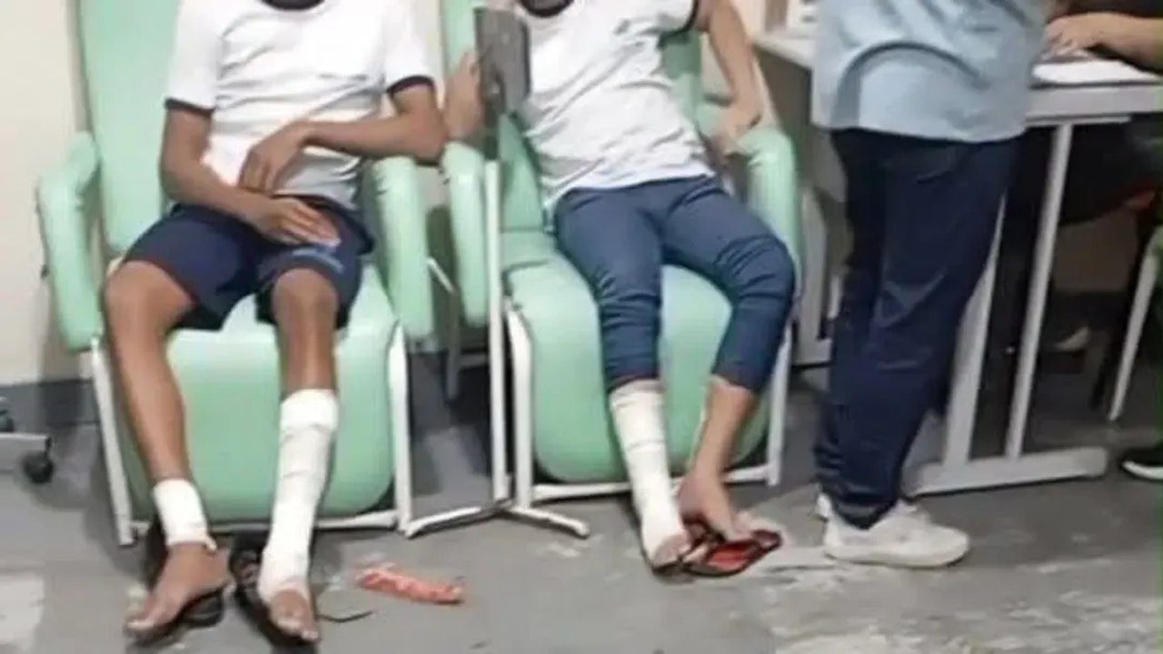 Estudantes com pernas enfaixadas após explosão em escola.