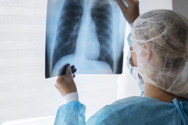 Médica analisa radiografia do tórax, possível problema em serviço de diagnóstico.