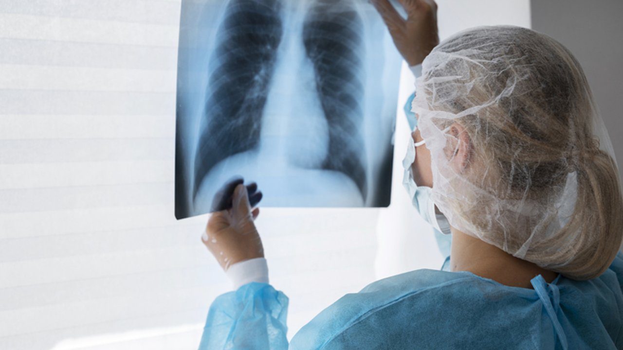 Médica analisa radiografia do tórax, possível problema em serviço de diagnóstico.